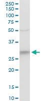 Anti-CYB5R3 Mouse Polyclonal Antibody