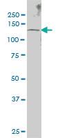 Anti-SENP6 Mouse Monoclonal Antibody [clone: 4B7]