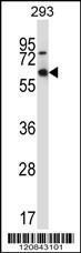 Anti-MEF2D Rabbit Polyclonal Antibody (AP (Alkaline Phosphatase))