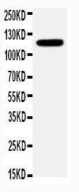 Anti-Integrin alpha 3 Rabbit Antibody