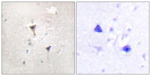 Immunohistochemical analysis of paraffin-embedded human brain tissue using Anti-PKC mu Antibody. The right hand panel represents a negative control, where the antibody was pre-incubated with the immunising peptide