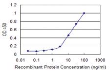 Anti-ULK2 Mouse Monoclonal Antibody [clone: 2A12]