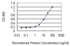 Anti-RNF126 Mouse Monoclonal Antibody [clone: 3F11]