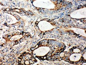 Anti-Integrin alpha 3 Rabbit Antibody