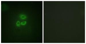 Immunofluorescence analysis of A549 cells using Anti-PKC mu Antibody. The right hand panel represents a negative control, where the antibody was pre-incubated with the immunising peptide