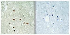 Immunohistochemical analysis of paraffin-embedded human brain using Anti-RRAGA + RRAGB Antibody 1:100 (4 °C overnight). The right hand panel represents a negative control, where the antibody was pre-incubated with the immunising peptide