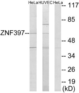 Western blot analysis of lysates from HeLa and HUVEC cells using Anti-ZNF397 Antibody. The right hand lane represents a negative control, where the Antibody is blocked by the immunising peptide