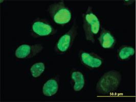 Anti-EIF2AK2 Mouse Monoclonal Antibody [clone: 1D11]