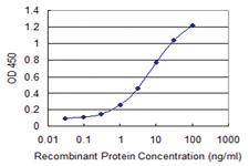 Anti-ULK2 Mouse Monoclonal Antibody [clone: 1A4]