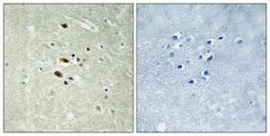 Immunohistochemical analysis of paraffin-embedded human brain using Anti-RRAGA + RRAGB Antibody 1:100 (4 °C overnight). The right hand panel represents a negative control, where the antibody was pre-incubated with the immunising peptide