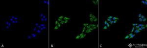 Immunocytochemistry/Immunofluorescence analysis of human cervical cancer cell line (HeLa), fixed in 4% formaldehyde for 15 min at room temperature, using Anti-p53 Antibody (A304903), at 1:100 for 60 minutes at room temperature