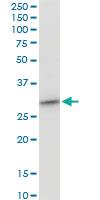 Anti-CYB5R3 Mouse Polyclonal Antibody