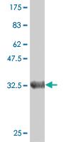 Anti-DGUOK Mouse Monoclonal Antibody [clone: 3E9]