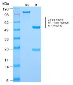 SDS-PAGE analysis of Anti-c-Myc Antibody [MYC2895R] under non-reduced and reduced conditions; showing intact IgG and intact heavy and light chains, respectively. SDS-PAGE analysis confirms the integrity and purity of the antibody.