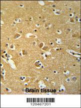 Anti-BABAM1 Rabbit Polyclonal Antibody (HRP (Horseradish Peroxidase))