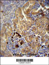 Anti-CD63 Rabbit Polyclonal Antibody (HRP (Horseradish Peroxidase))