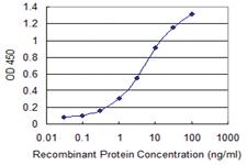 Anti-ULK2 Mouse Monoclonal Antibody [clone: 3H8]