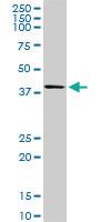 Anti-SPHK1 Mouse Monoclonal Antibody [clone: 1D6]