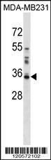 Anti-LGALS8 Rabbit Polyclonal Antibody (Biotin)