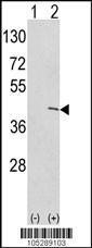 Anti-ETNK1 Rabbit polyclonal antibody