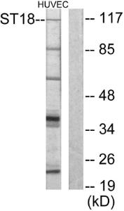 Western blot analysis of lysates from HUVEC cells using Anti-ZNF387 Antibody. The right hand lane represents a negative control, where the antibody is blocked by the immunising peptide