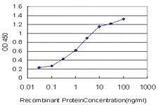 Anti-ULK2 Mouse Monoclonal Antibody [clone: 5E4]