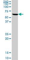 Anti-CCT7 Mouse Monoclonal Antibody [clone: 1D6]