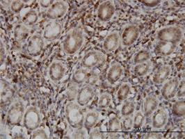 Anti-SENP6 Mouse Monoclonal Antibody [clone: 4B7]