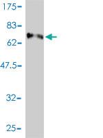 Anti-E2F8 Mouse Monoclonal Antibody [clone: 3E9-2F5]