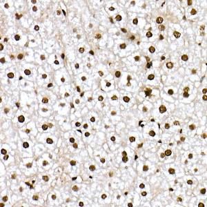 Immunohistochemistry analysis of paraffin-embedded mouse liver using Anti-FOXO1A (phospho Ser319) Antibody (A308977) at a dilution of 1:50 (40x lens)