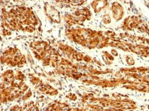 Immunohistochemical analysis of formalin-fixed, paraffin-embedded human uterus using Anti-Calponin 1 Antibody [CNN1/832]