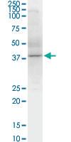 Anti-SPHK1 Mouse Monoclonal Antibody [clone: 1D6]