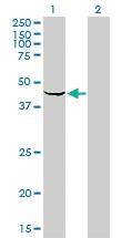 Anti-SPHK1 Mouse Monoclonal Antibody [clone: 1D6]