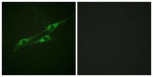 Immunofluorescence analysis of NIH/3T3 cells using Anti-IL-13R Antibody. The right hand panel represents a negative control, where the antibody was pre-incubated with the immunising peptide.