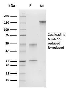 SDS-PAGE analysis of Anti-Calponin 1 Antibody [CNN1/832] under non-reduced and reduced conditions; showing intact IgG and intact heavy and light chains, respectively SDS-PAGE analysis confirms the integrity and purity of the antibody