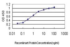 Anti-SENP6 Mouse Monoclonal Antibody [clone: 4B7]