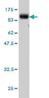 Anti-FAM65B Mouse Monoclonal Antibody [clone: 2F6-1A11]