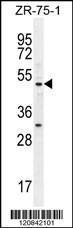 Anti-MEF2D Rabbit Polyclonal Antibody (Biotin)