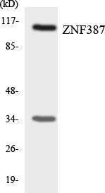 Western blot analysis of the lysates from COLO205 cells using Anti-ZNF387 Antibody