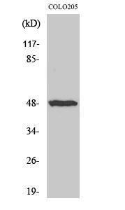 Western blot analysis of various cells using Anti-IL-13R Antibody