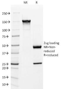 SDS-PAGE analysis of Anti-Mitochondria Antibody [113-1] under non-reduced and reduced conditions; showing intact IgG and intact heavy and light chains, respectively. SDS-PAGE analysis confirms the integrity and purity of the antibody