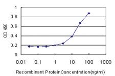 Anti-SPHK1 Mouse Monoclonal Antibody [clone: 1D6]