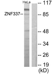 Western blot analysis of lysates from HeLa cells using Anti-ZNF337 Antibody. The right hand lane represents a negative control, where the antibody is blocked by the immunising peptide