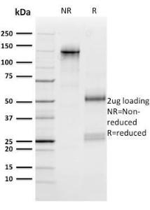 SDS-PAGE analysis of Anti-n-Myc Antibody [NMYC-1] under non-reduced and reduced conditions; showing intact IgG and intact heavy and light chains, respectively. SDS-PAGE analysis confirms the integrity and purity of the antibody