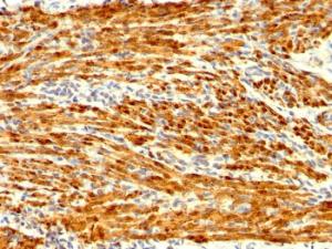 Anti-Calponin 1 antibody