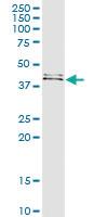 Anti-FUT1 Polyclonal Antibody Pair