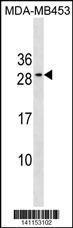 Anti-BCL2 Rabbit Polyclonal Antibody (AP (Alkaline Phosphatase))