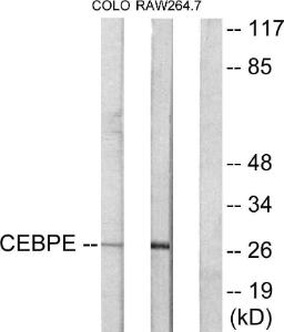 Western blot analysis of lysates from LOVO and RAW264.7 cells using Anti-CEBPD + CEBPE Antibody. The right hand lane represents a negative control, where the Antibody is blocked by the immunising peptide