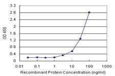 Anti-KCNE1 Antibody Pair