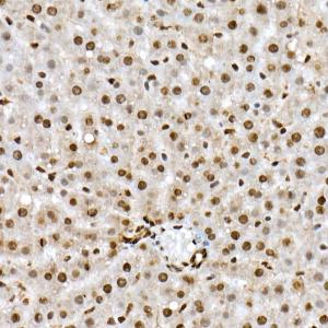 Immunohistochemistry analysis of paraffin-embedded rat liver using Anti-FOXO1A (phospho Ser319) Antibody (A308977) at a dilution of 1:50 (40x lens)